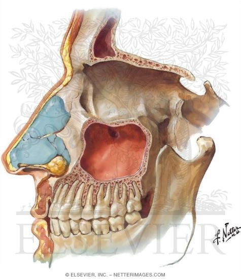 Paranasal Sinuses: Lateral Dissection
