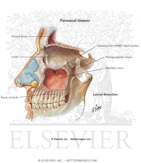 Paranasal Sinuses: Lateral Dissection