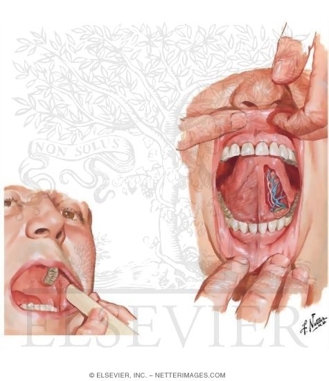 Watermarked preview of unlabeled image: Inspection of Oral Cavity