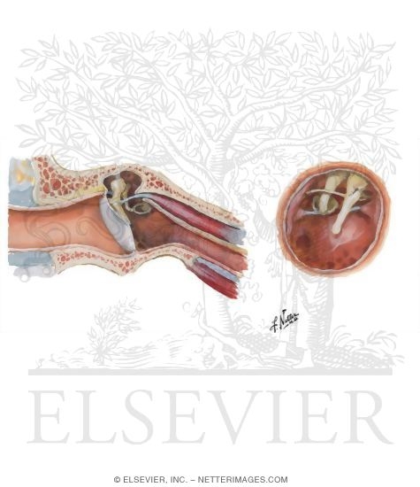 Watermarked preview of unlabeled image: Externl Ear and Tympanic Cavity
