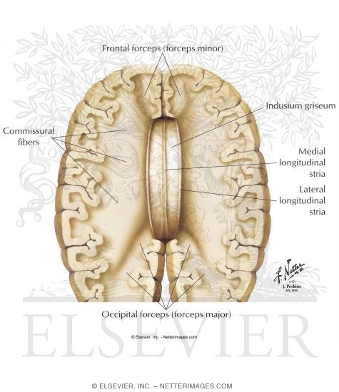 Corpus Callosum: Schematic View of the Lateral Extent of Major Components