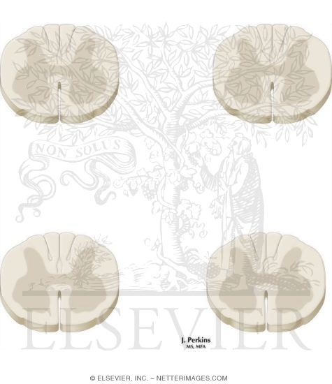 Watermarked preview of unlabeled image: Spinal Somatic Reflex Pathways