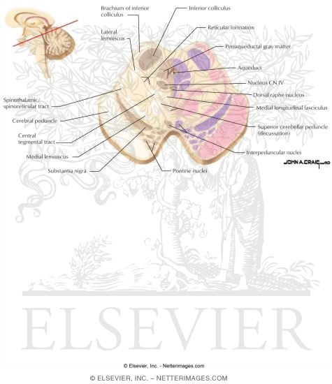 Midbrain - Level of the Inferior Colliculus