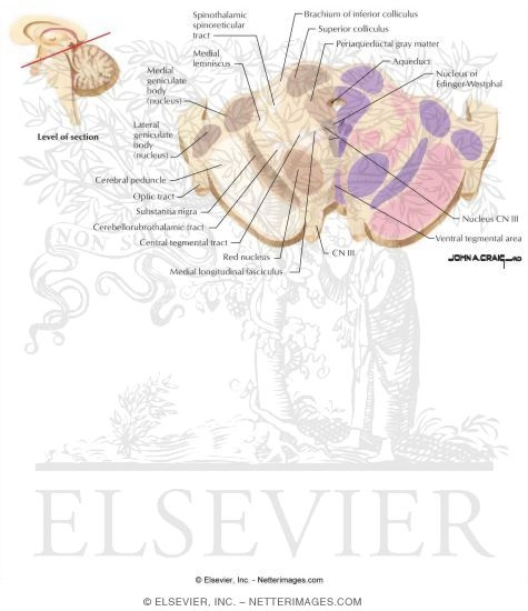 Midbrain - Level of the Medial Geniculate Body