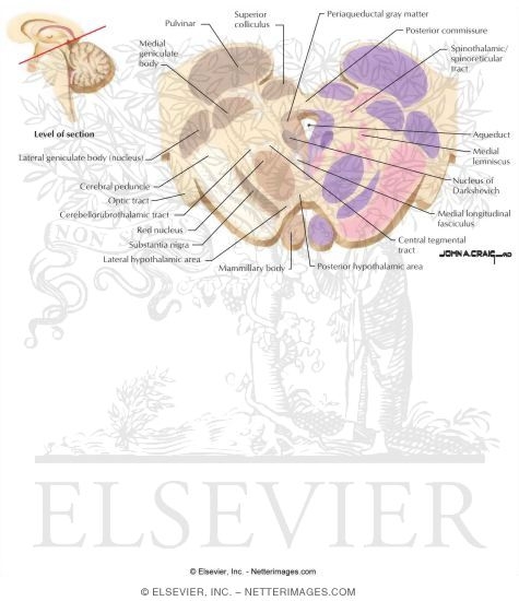 Midbrain / Diencephalon Junction - Level of the Posterior Commissure