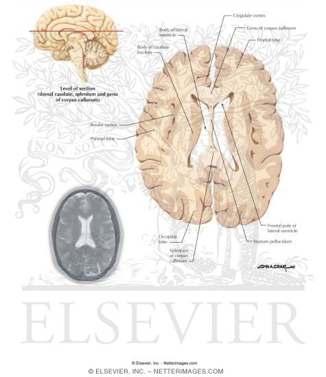 Dorsal Caudate, Splenium, and Genu of Corpus Callosum