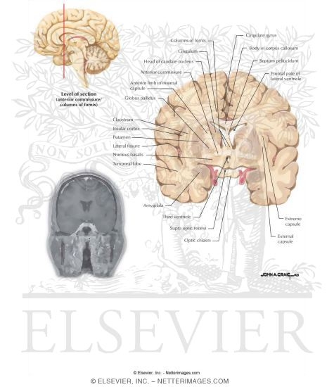 Coronal Sections Through the Forebrain: Anterior Commissure / Columns of Fornix