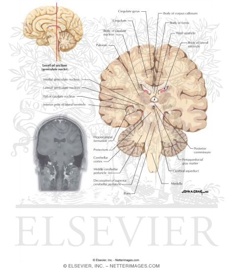 Coronal Sections Through the Forebrain: Geniculate Nuclei
