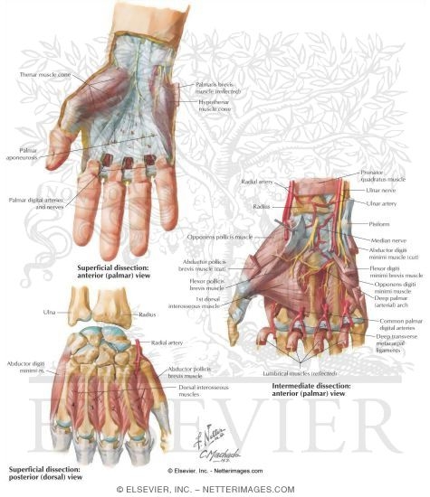 Watermarked preview of labeled image: Muscles of the Hand