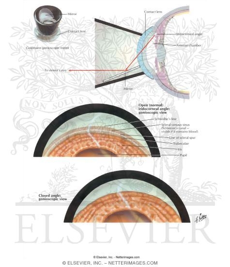 Gonioscopy
Anterior Chamber Angle of Eye