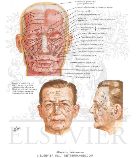 Lines of Incision for Removal of Skin Tumors of the Face