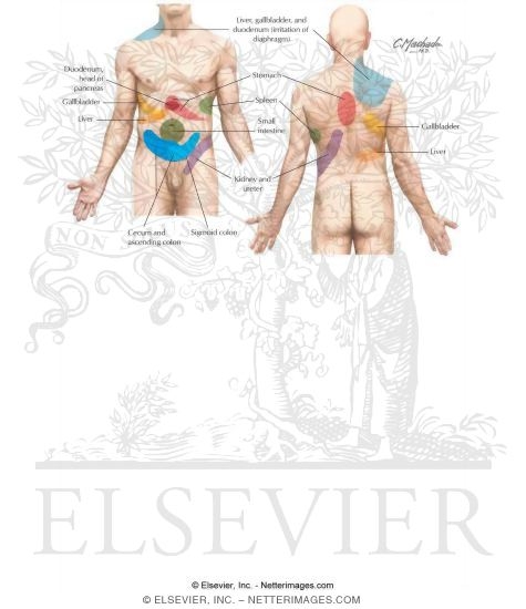 Visceral Referred Pain