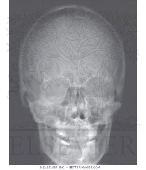 Skull: Anteroposterior Radiograph