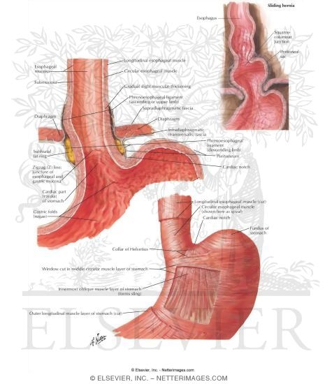 Watermarked preview of unlabeled image: Esophagogastric Junction
