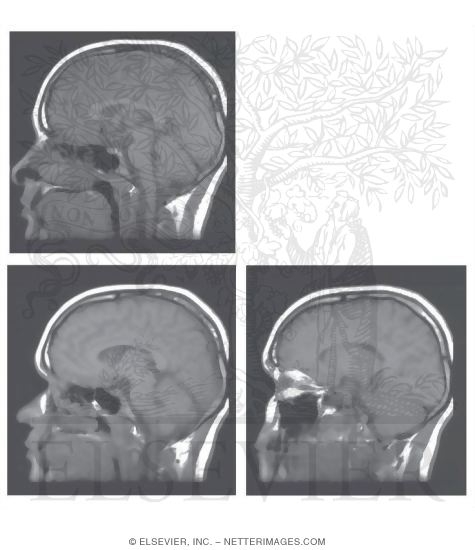 Head Scans: Sagittal MR Images