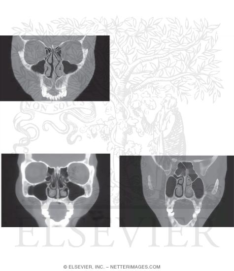 Head Scans: Coronal CT Images