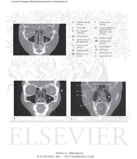 Head Scans: Coronal CT Images