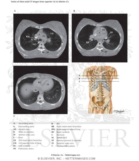 Chest Scans: Axial CT Images