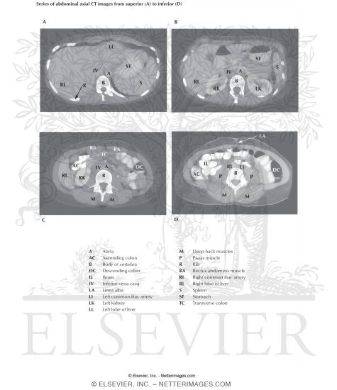 Abdominal Scans: Axial CT Images