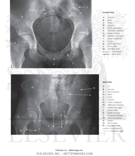 Female and Male Pelvis Radiographs
