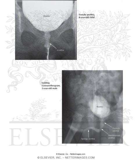Watermarked preview of labeled image: Male and Female Cystourethrograms