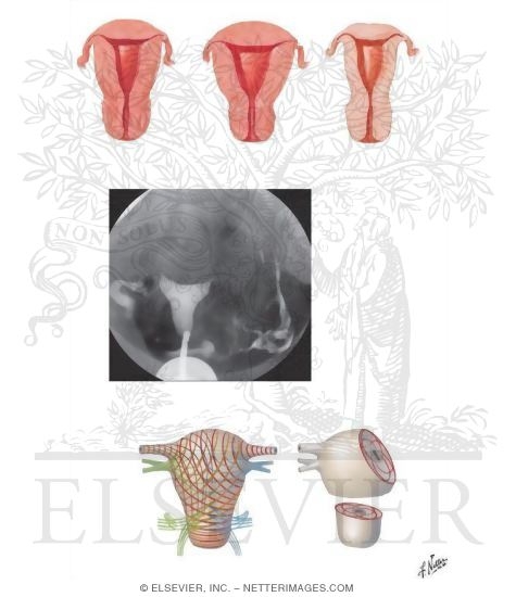 Watermarked preview of unlabeled image: Uterus: Age Changes and Muscle Pattern