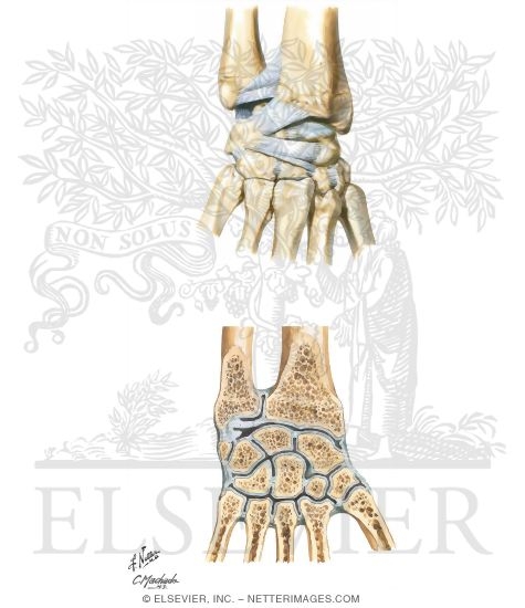 Ligaments of Wrist
