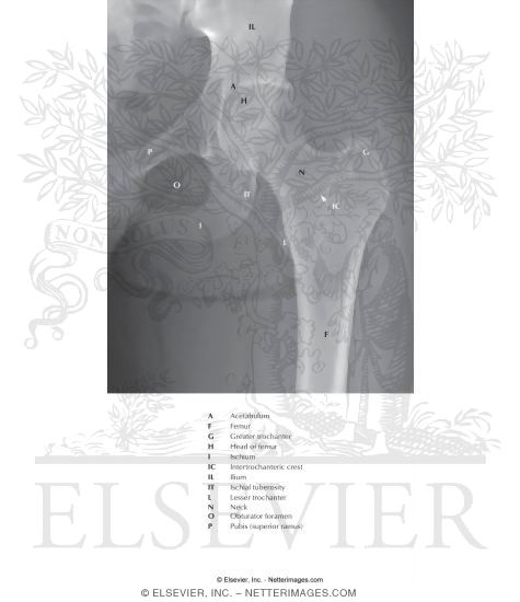Hip Joint: Anteroposterior Radiograph