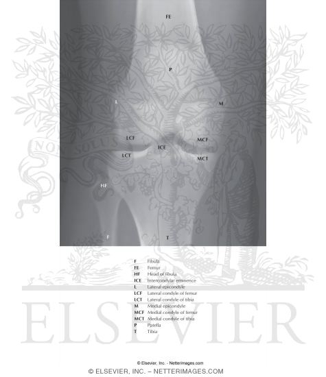 Watermarked preview of labeled image: Knee: Anteroposterior Radiograph