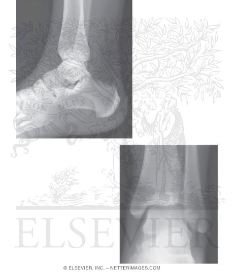 Ankle: Radiographs