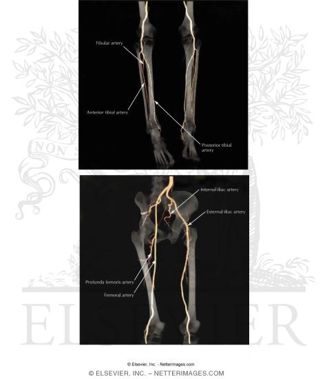 CT Angiograms of Arteries of the Lower Limb