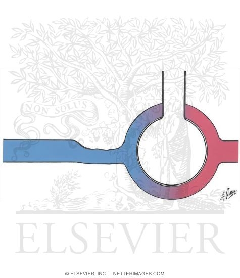 Watermarked preview of unlabeled image: Pulmonary Vascular Resistance