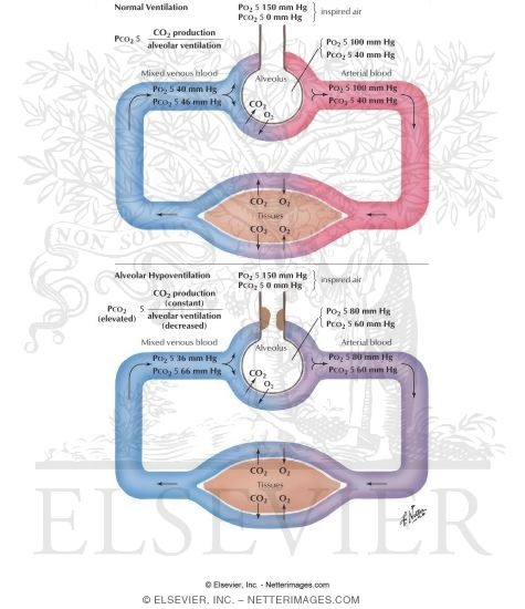 Watermarked preview of labeled image: Normal Ventilation
