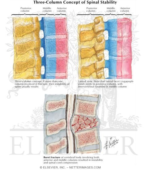 Three-Column Concept of Spinal Stability