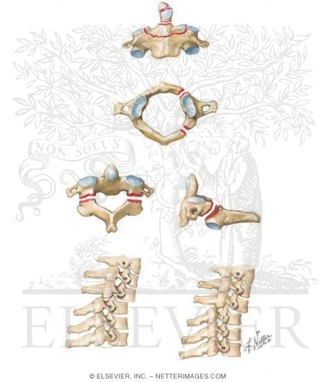 Watermarked preview of unlabeled image: Spinal Trauma