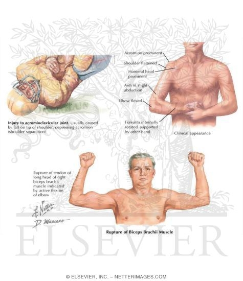 Watermarked preview of labeled image: Medical History of the Shoulder