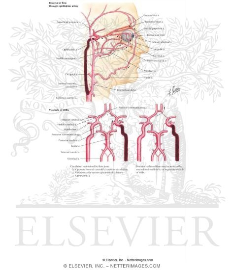 Potential Collateral Circulation Following Occlusion of Internal Cartoid Artery