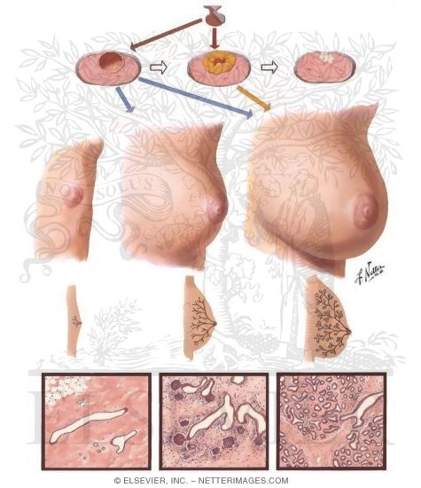 female breast development picture Female breast development picture
