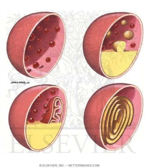 Watermarked preview of unlabeled image: Electron Photomicrographs Showing Lysosomes