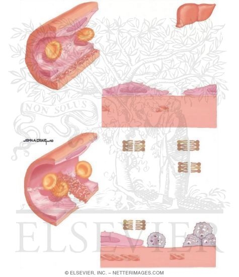 Watermarked preview of unlabeled image: Bleeding Problems: Vascular Endothelium Function