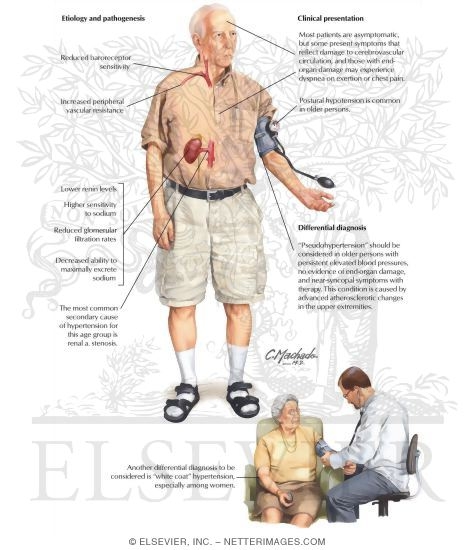 Hypertension in the Elderly