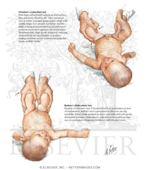 Watermarked preview of labeled image: Recognition of Congenital Dislocation of the Hip