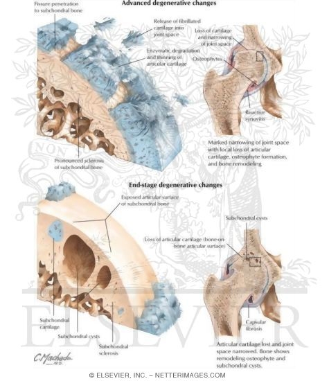 Watermarked preview of labeled image: Joint and Articular Changes