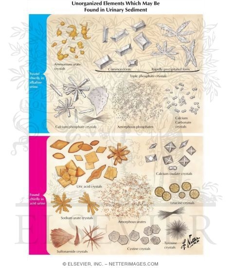 Unorganized Elements Which May Be Found In Urinary Sediment