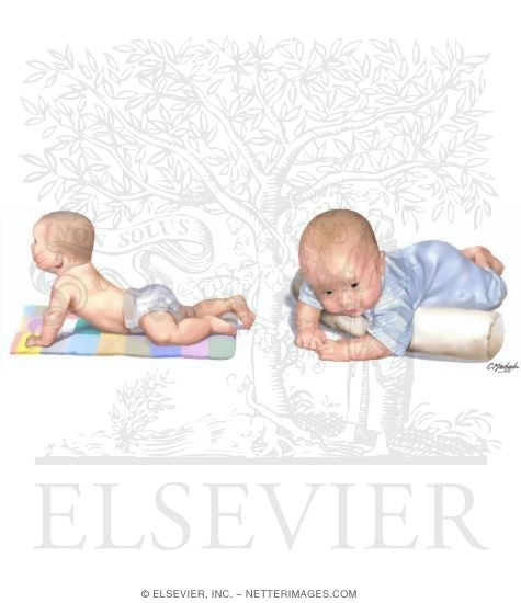 Plagiocephaly repositioning shop
