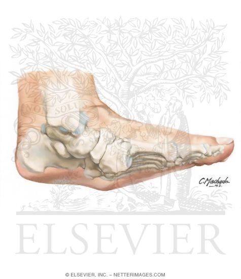 Watermarked preview of unlabeled image: Charcot Fracture