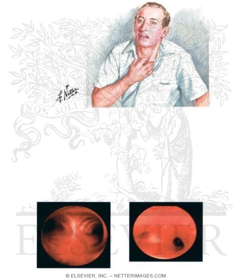 Clinical Features of Asthma