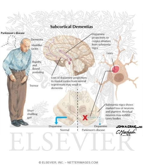 Subcortical Dementias