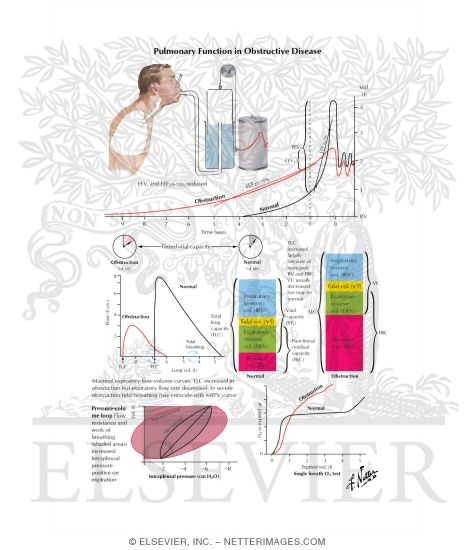 Watermarked preview of labeled image: Pulmonary Function in Obstructive Disease