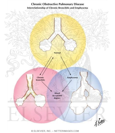 Chronic Obstructive Pulmonary Disease (COPD)